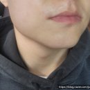 이노바의원 | 충주 이노바의원 : 남자 수염 레이저제모 다녀온 후기, 진료시간, 가격정보, 주차정보