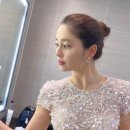 서울 내돈내산 여자 절개 헤어라인 모발이식 솔직 후기