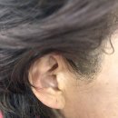 스타키보청기(진주센터) | 평택보청기 보청기 착용 후기 스타키 평택센터