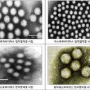 식중독증상 굴 노로바이러스 증상 원인 이미지