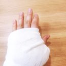 한강성심병원 응급실 후기 비용 화상 초기 대처 보험청구 에펙신안연고