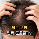 직구넷 | 케라넷 효능 탈모 영양제 고민이라면? 가격부터 부작용까지 확인하세요