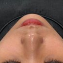 이마상사 김포지점 | 김포 피부관리 나비존 모공관리 고민이라면 비비드엘