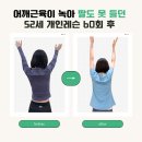 에코필라테스플러스후곡점 | [후곡필라테스] 스테로이드 주사 부작용,극상근 건염 52세 개인레슨 리얼 후기 | 에코필라테스 후곡점