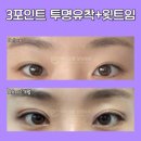 아이그램성형외과 이미지