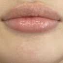 비오페이스의원 이미지