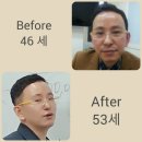 리모사 스킨독스 이미지