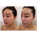 다산에스테틱 시그니처 울트라 윤곽샷 대만족_ 뷰티다룸 다산점