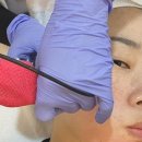 에그뮤즈 스킨스칼프 이미지