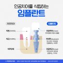 청주연치과의원 | 청주치과추천 치료 전 기준을 먼저 살펴야 하는 이유