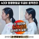 대전 40대 땅콩형얼굴관리 안면비대칭 두골비1회만에 머리 사이즈 작아진 손앤미 후기
