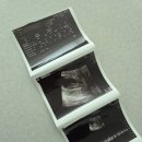 임신일기-24. 9주 초음파ㅣ삼성화재 태아 실손 및 우체국 무료보험 계약