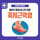 족저근막염 증상, 발바닥 통증 원인과 치료 및 예방법 이미지