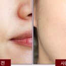 셀리턴LED마스크