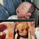 강서구 유광사 산부인과 BCG 예방접종 피내주사후기 및 영유아검진 1차 후기