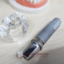 튼튼내이사랑치과의원 이미지