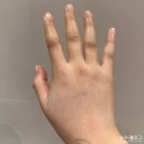 빠마떡볶이 | 이천 양정분산부인과 유도분만 실패 후 제왕절개 초산모 후기