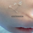 용한약국 | 독일 HYLO 힐로 Night 나이트 gel 눈 건조 할때 안약 안 연고 스마일 라식 안약 추천 사용방법
