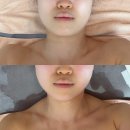 광명제일한의원 | 약손명가 에스테틱 광명점 | 광명 피부관리 얼굴관리 약손명가 양악관리 1회차 솔직 후기