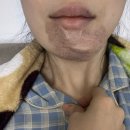 함희정성형외과의원 네이버블로그