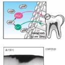 이오균치과의원 | 대전 아이콘레진 비포애프터 후기 화이트스팟 반점치 말끔히 지워내는 치아미백전문 유니나치과