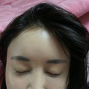 참빗헤어샵 - 칠곡군 북중리3길 69 | 참빗박박_리얼후기 3달째 모발부자됨