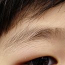 케이탑안과의원 이미지