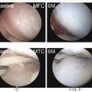 무릎 퇴행성 관절염에도 효과 있어 이미지