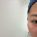 세종스노우의원 | [세종 피부과] 세종 스노우의원 포텐자 후기