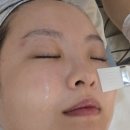 비디알(bdr)