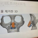 글로비다 이미지