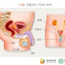 전립선 비대증 원인 증상 치료 전립선 비대증 예방법 이미지