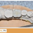 다이안치과기공소 이미지