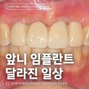 새망미메디칼빌딩 | 부산 앞니 임플란트로 달라질 수 있는 일상