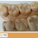 아이디치과기공소 이미지