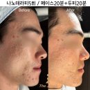 러브미모어