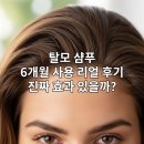 샴푸, 진짜 효과 있을까? 6개월간 직접 써보고 분석한 성분과 두피 변화 리얼 후기 (내 머리가 증명한다!)