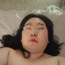 하단 신부관리_3백만원 쓴 후기_ 슈링크,데콜테,경락,IPL,보톡스_바바성형외과