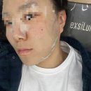 울산 무거동 피부관리 “해리스뷰티”