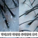 홈플러스 작전점 | 계양구 탈모 관리, 닥터모락 작전점 두피관리 후기