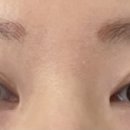 예스안과의원 이미지