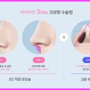 바비라인 이미지