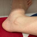 없음 | 써마드 PLX 내돈내산 효과없음? 사용법 후기