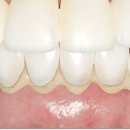 맑은플란트치과의원 이미지