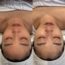 맑을린피부관리 | 광고X) 광주 피부관리샵 맑을린 후기