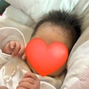 리젠의원 | 산부인과의원 제왕절개 출산 후 입원 후기 5일차 6일...유축기, 스카리젠 흉터연고, 몸상태 및 회복...