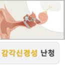 신창보청기 네이버블로그