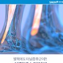 아킬레스건염 증상 아킬레스건통증 정리 이미지