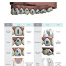 밀레니엄치과의원 | 투명교정기 가격으로 이 정도 효과 어때요? (우수시술 치과)
