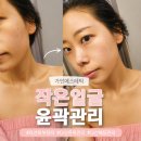 다산피부관리 추천! 가인에스테틱 다산윤곽관리 작은얼굴 관리 후기